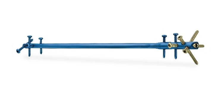 Expert Tibia Nail product image