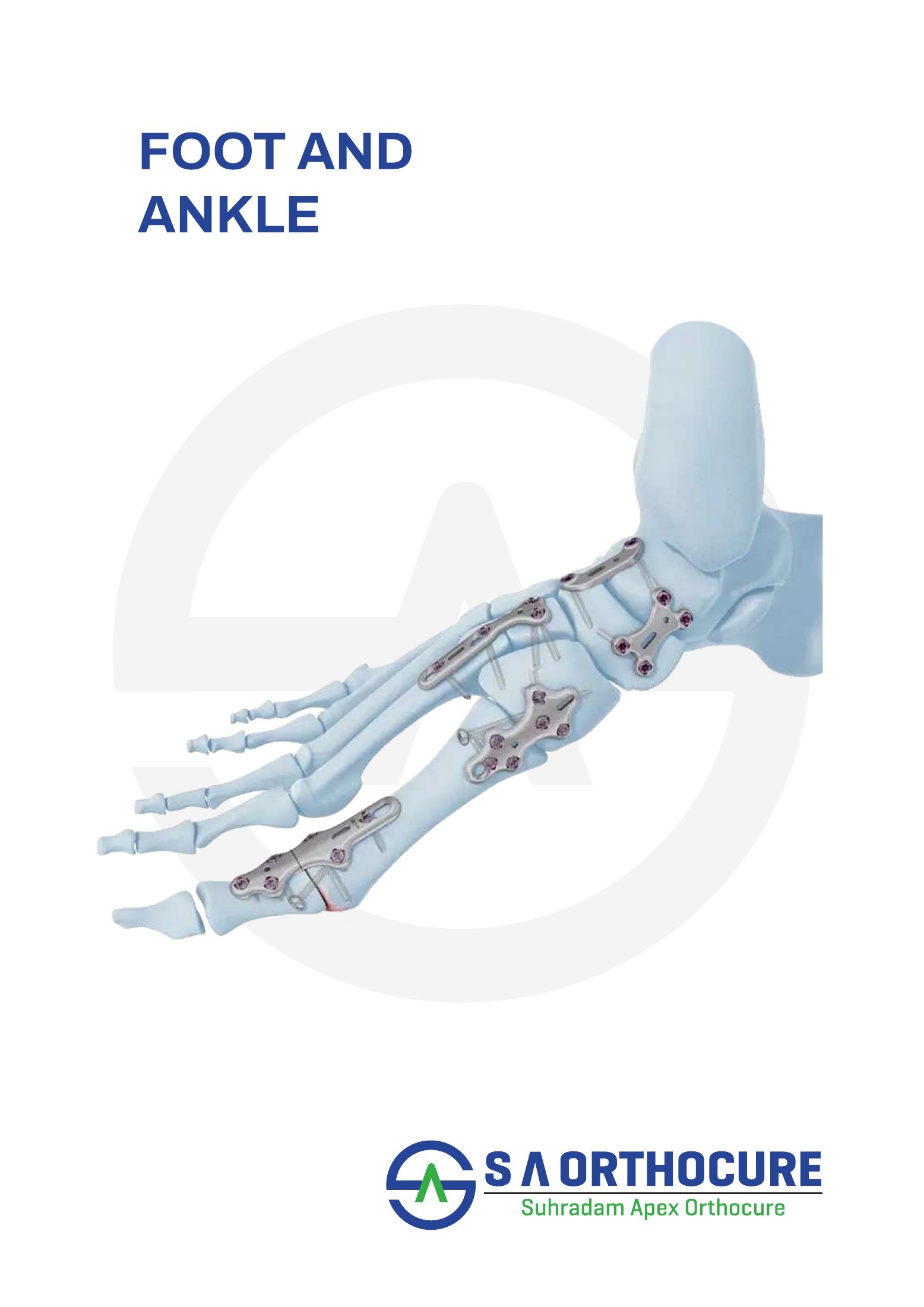 Foot and Ankle product system